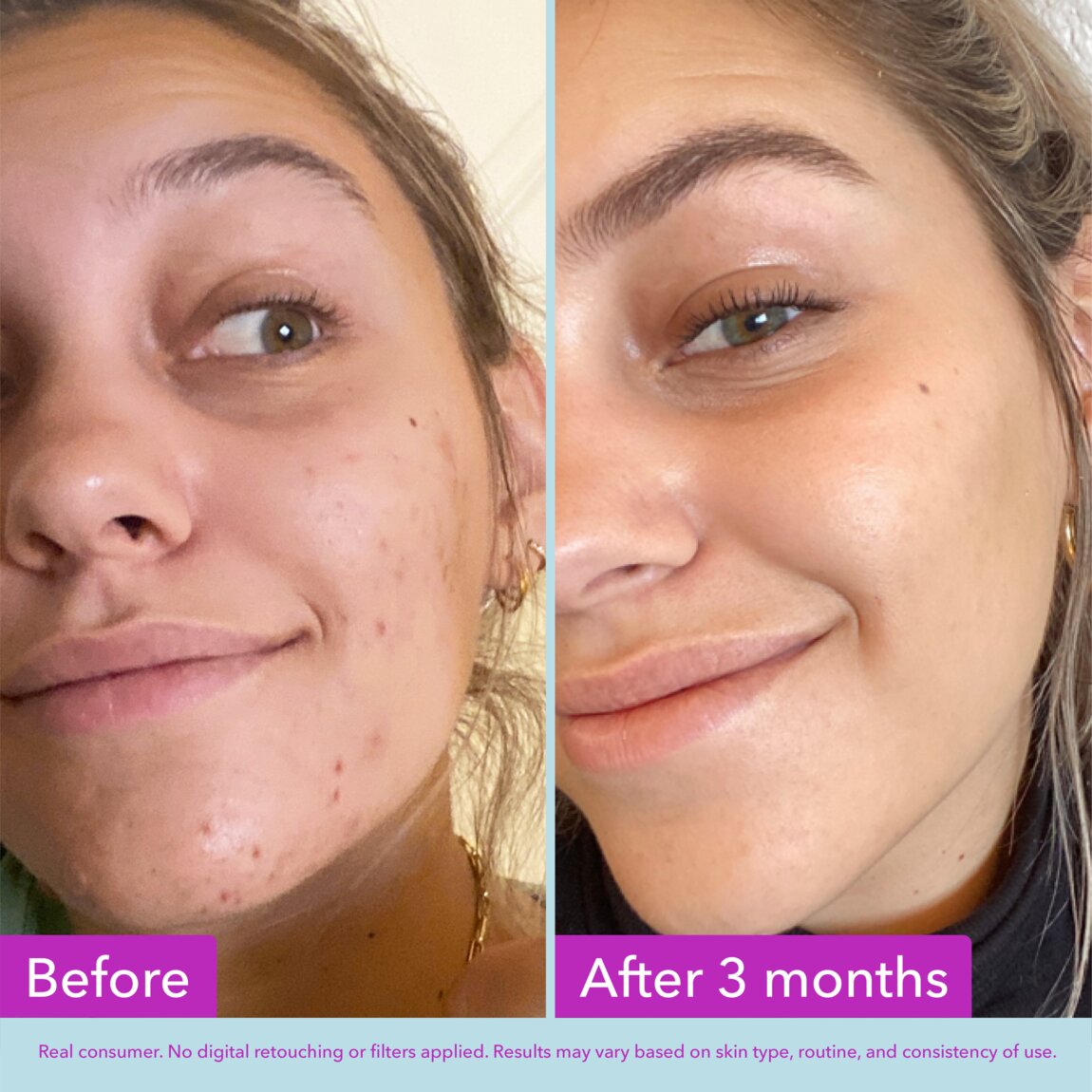 niacinamide-brightening-toner-m5 zb_p.jpg