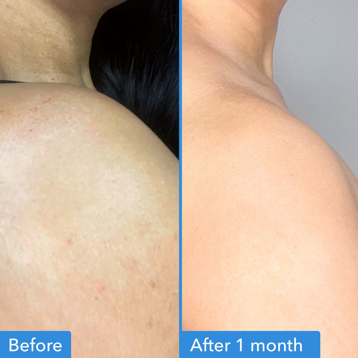 discoloration-correcting-body-treatment-v7 zb_p.jpg